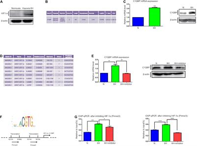 Hypoxia-Mediated Complement 1q Binding Protein Regulates Metastasis and Chemoresistance in Triple-Negative Breast Cancer and Modulates the PKC-NF-κB-VCAM-1 Signaling Pathway